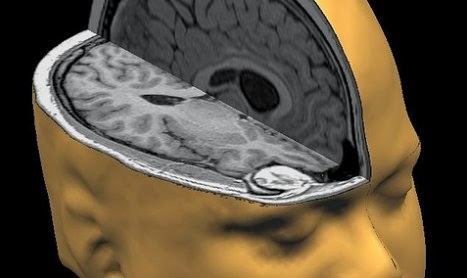 brain-scans-show-the-real-impact-love-has-on-a-childs-brain