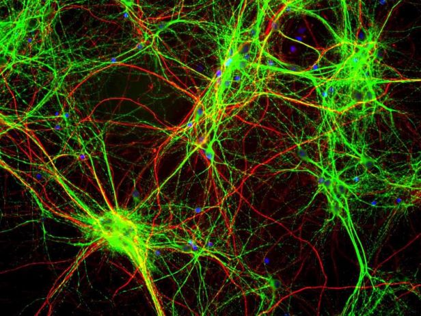 Brain_cells_stained