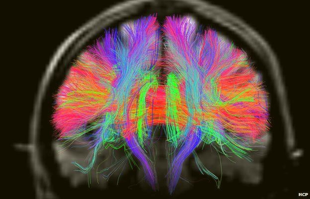 1-resilience-concept-8